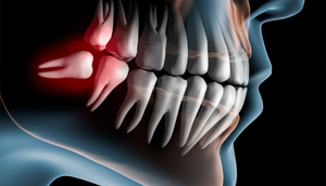 Cirugía Oral y Maxilofacial