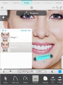 Diseño de sonrisas por ordenador