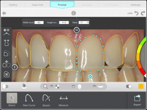 Tecnología al servicio de la estética dental